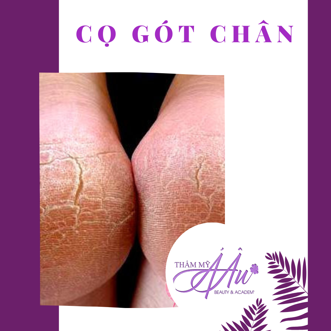 Cọ gót - Massage chân cơ bản